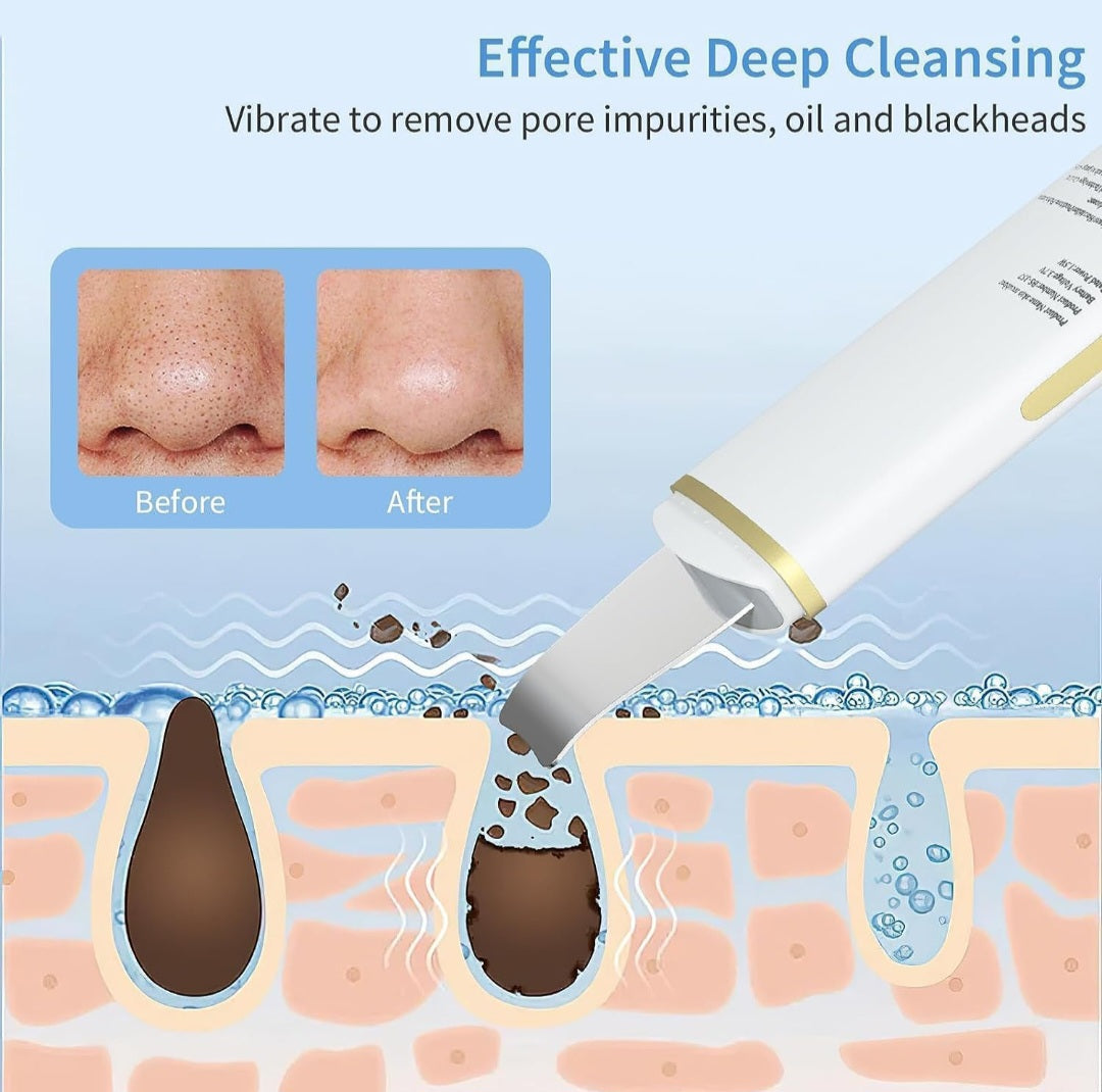 Beauty Ultrasonic Skin Scrubber